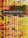 prada acta neuropathologica|acta neuropathologica website.